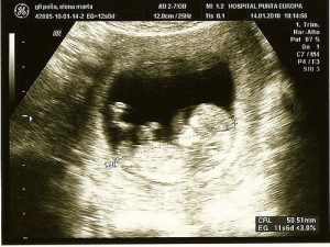 임신 합병증을 감지하는 혁신 기술