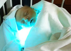 유아 황달은 무엇이고 어떻게 치료할까?