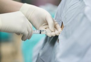 보행성 경막외마취 및 분만에 미치는 영향