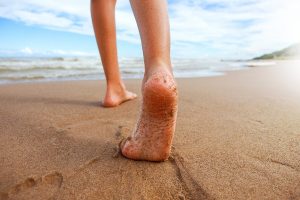 아이들의 안짱다리를 교정하는 방법