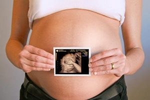 아기의 생명 유지 기관: 태반, 탯줄 그리고 양막낭