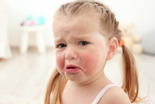 아이들에게 가장 흔한 음식 알레르기
