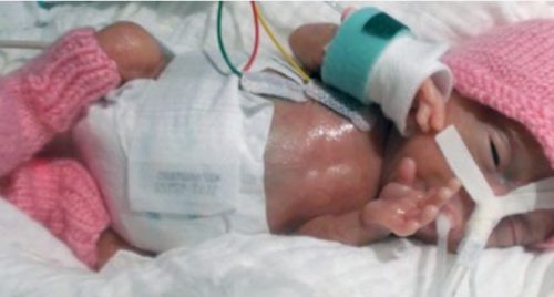 초미숙아가 부모에게 전하는 감동과 위대한 사랑