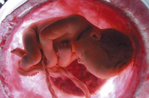 아기의 생명 유지 기관: 태반, 탯줄 그리고 양막낭