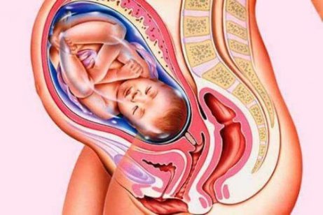 자궁경부 무력증의 위험 요인, 결과 및 치료법