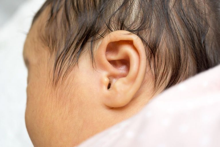 신생아 청각 장애를 조기에 발견하기