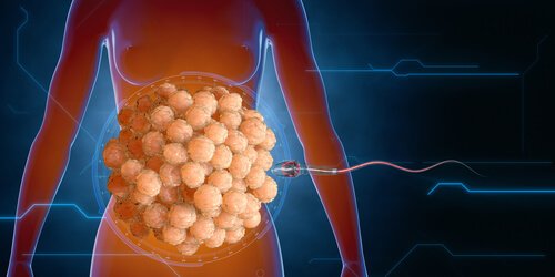 사정이 이뤄지면 생존을 위한 정자의 싸움이 시작한다.