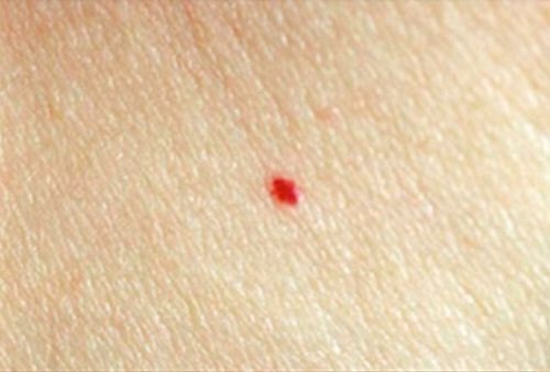 점의 유형을 구별하는 방법