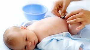 신생아의 탯줄을 자른 후 배꼽을 관리하는 방법
