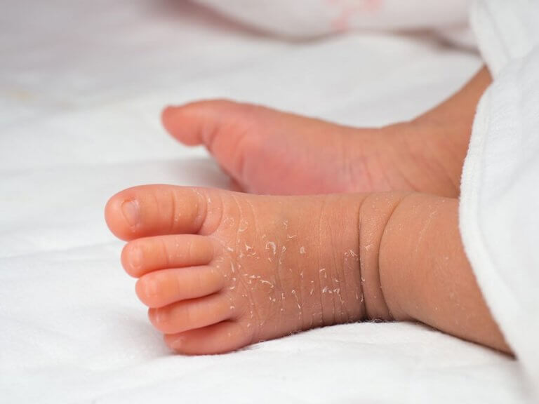 신생아의 피부를 관리하는 방법