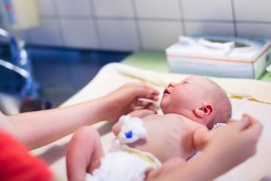신생아 탯줄을 자른 후 배꼽을 관리하는 방법