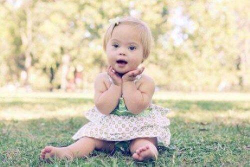 염색체의 상염색체이상증