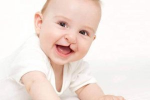 두개안면 이상의 가장 흔한 유형은 무엇일까?