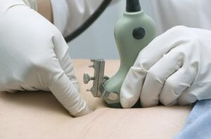 양수 과소 합병증의 치료