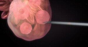 인공 수정은 어떻게 진행될까