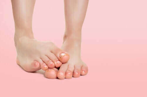 소아 발바닥 피부염은 무엇일까