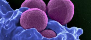 호중구는 왜 중요할까?